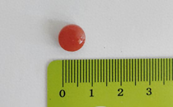 八九游体育旬老人重症肺炎绵延不愈医生从气管取出一枚“肇事”小药丸(图1)