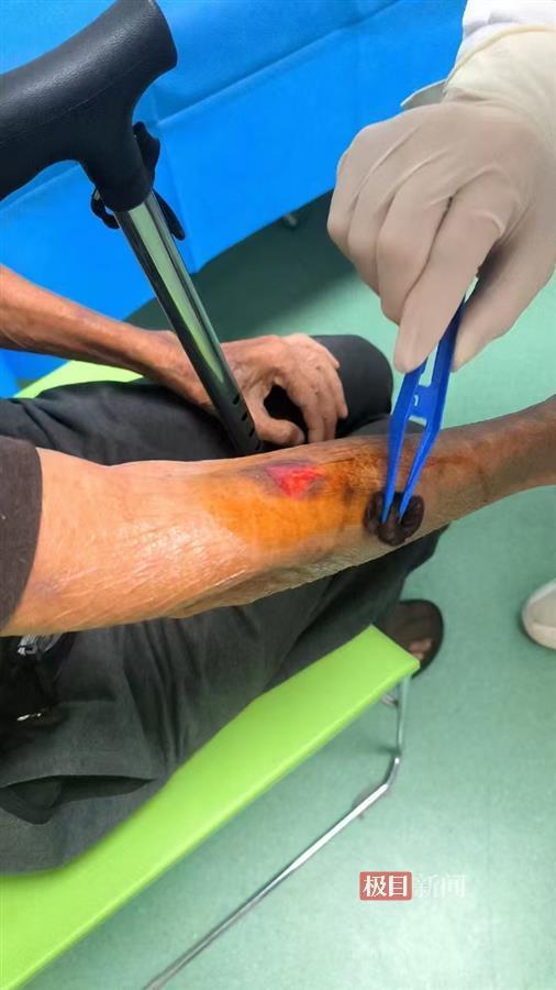 九游体育极目帮办|两只巨嘴鸟打架意外抓伤九旬老人极地海洋公园承诺赔偿3000元医疗费(图1)